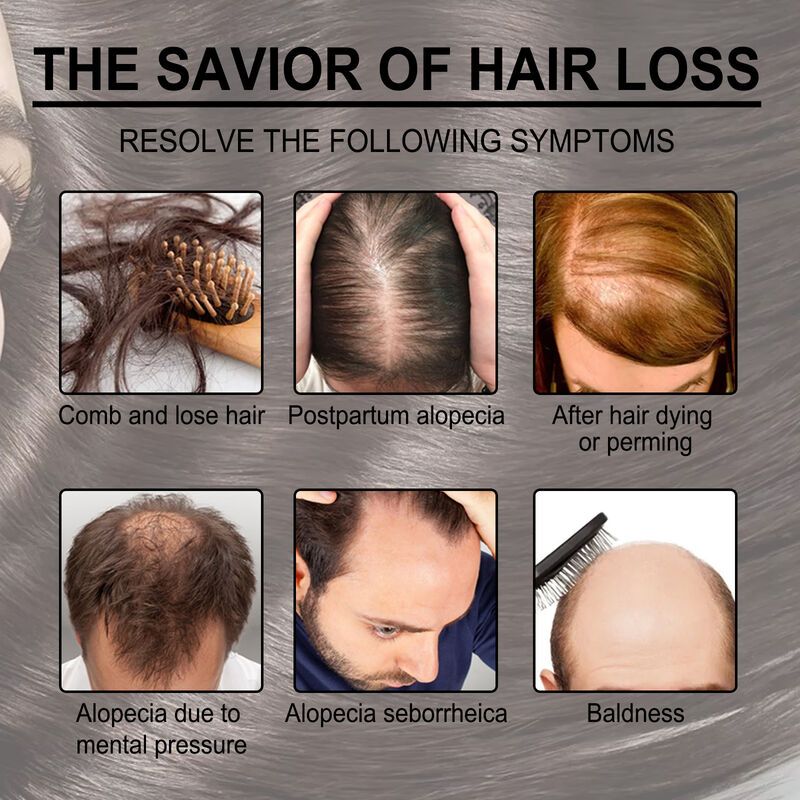 Rosemary Hair Care Essential Oil for Preventing Broken Hair and Hair Growth Essential Oil for Preventing Hair Loss and Nourishing Scalp Essential Oil